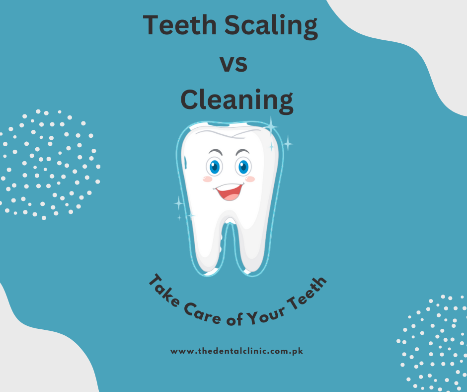 Teeth Scaling vs Cleaning