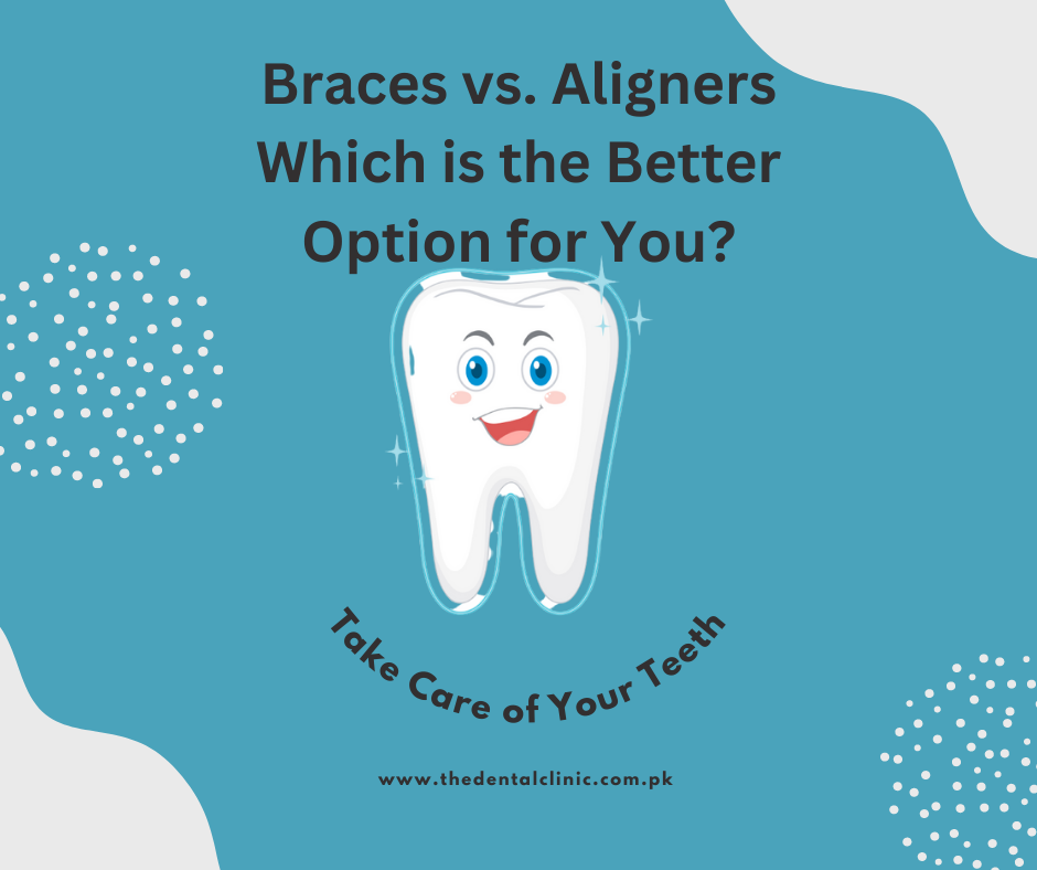 Braces vs. Aligners: Which is the Better Option for You?