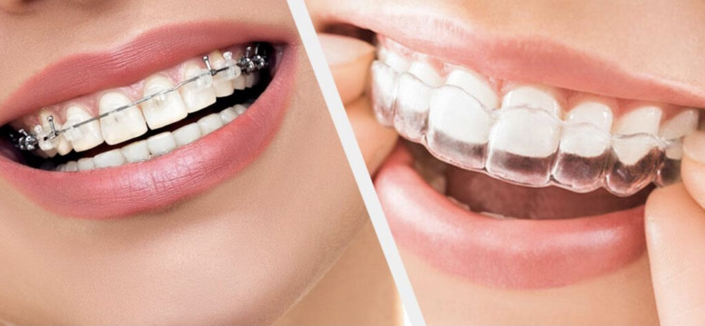 Best Orthodontist in Karachi
