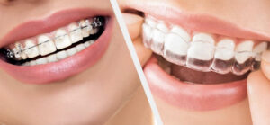 Best Orthodontist in Karachi
