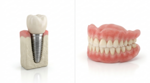 implants vs dentures
