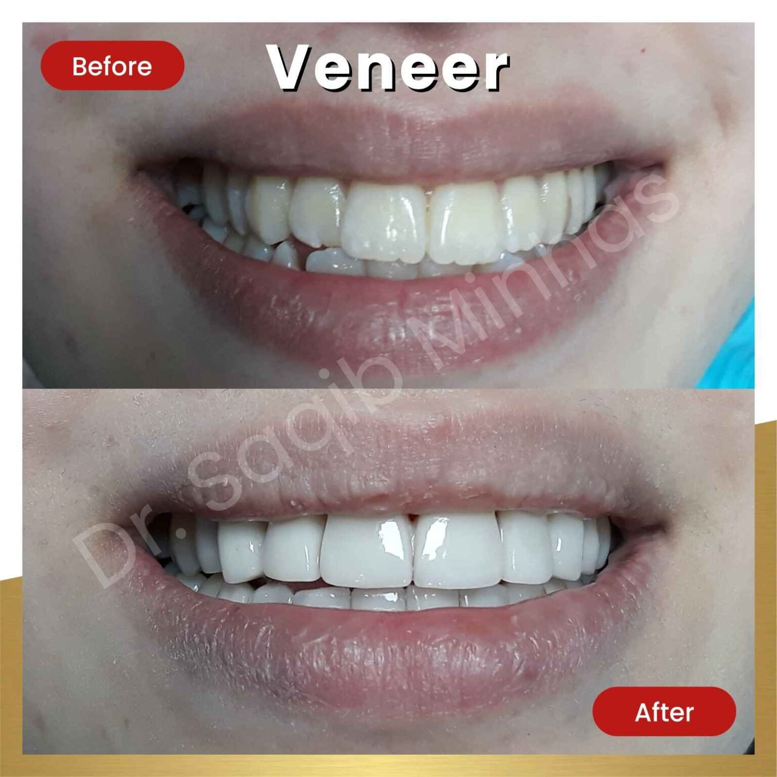 Best Dentist In Karachi Dr Saqib Minhas The Dental Clinic best-dentist-in-karachi-dr-saqib-minhas-the-dental-clinic