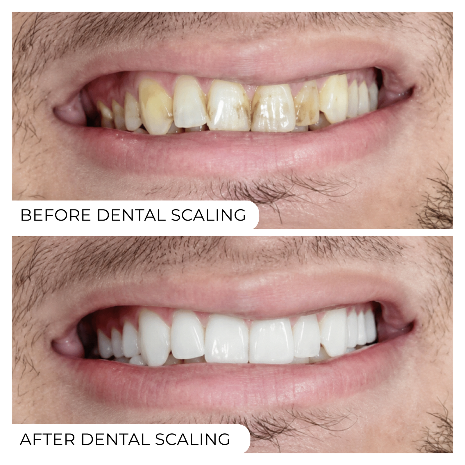 Before After-01