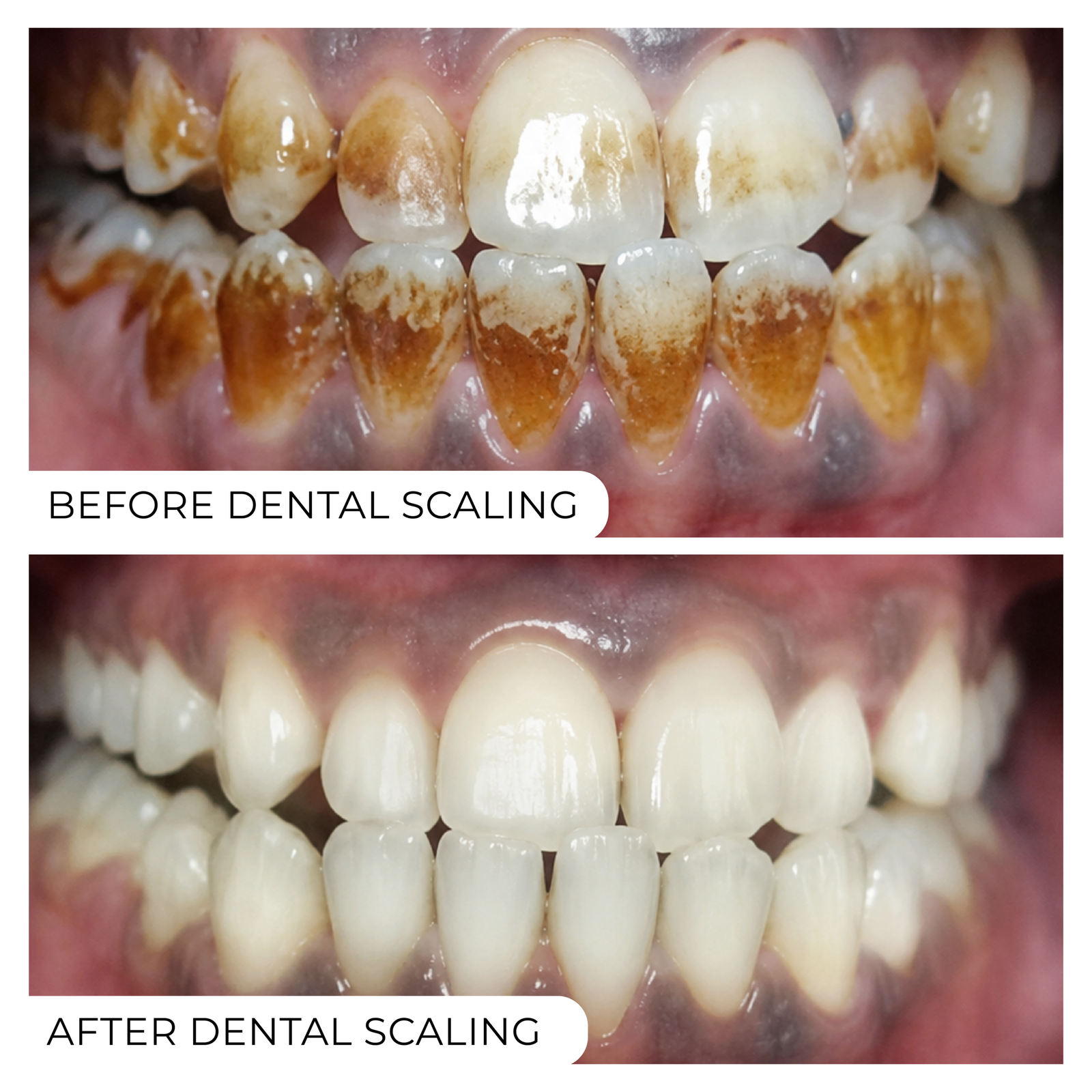 Before After-03