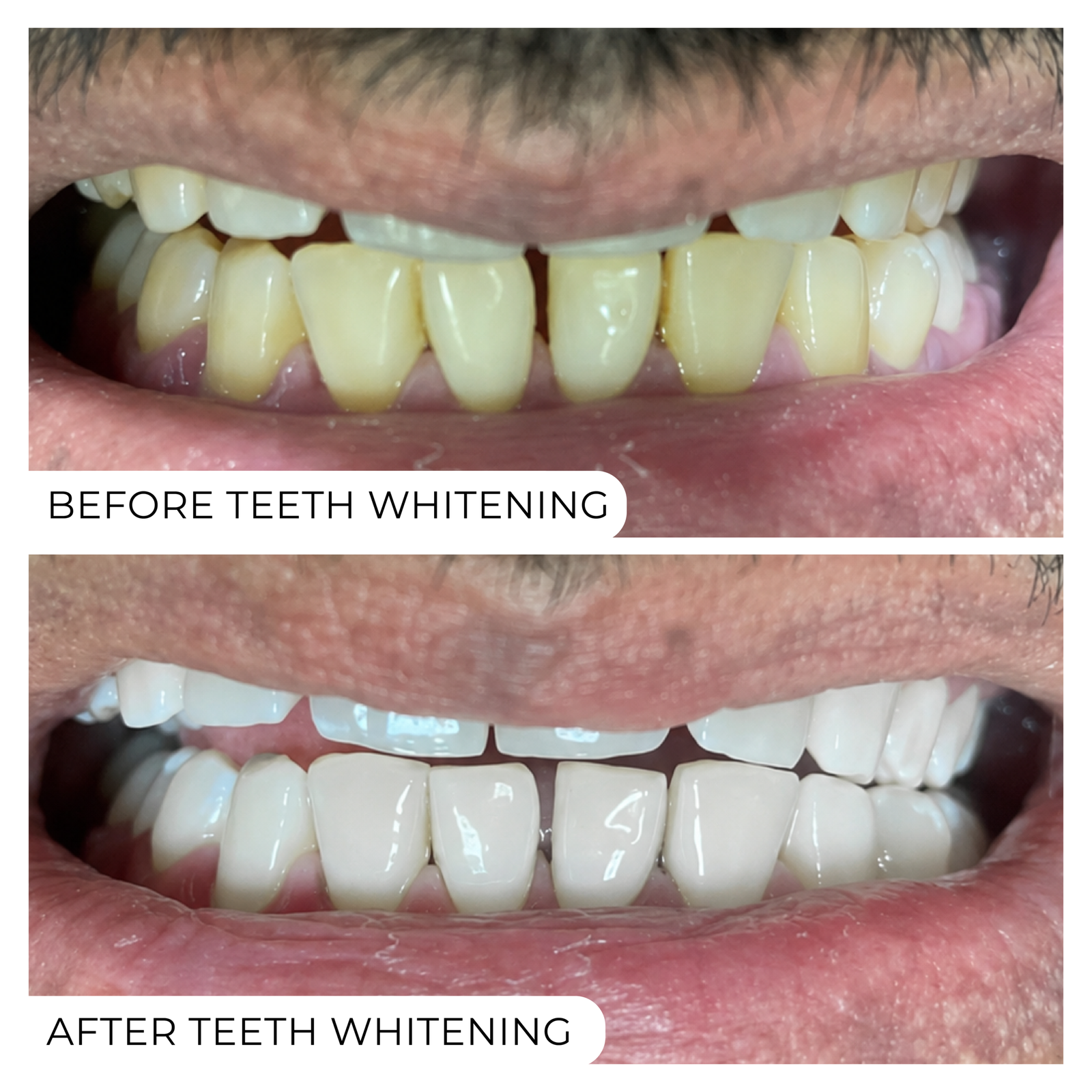 Before After-04