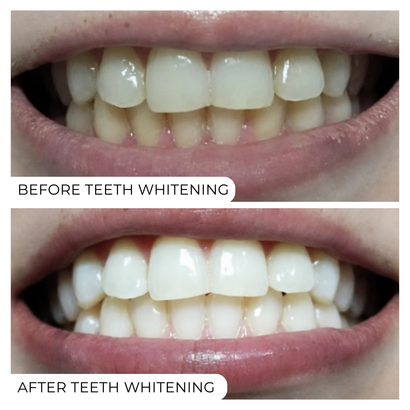 Before After-05