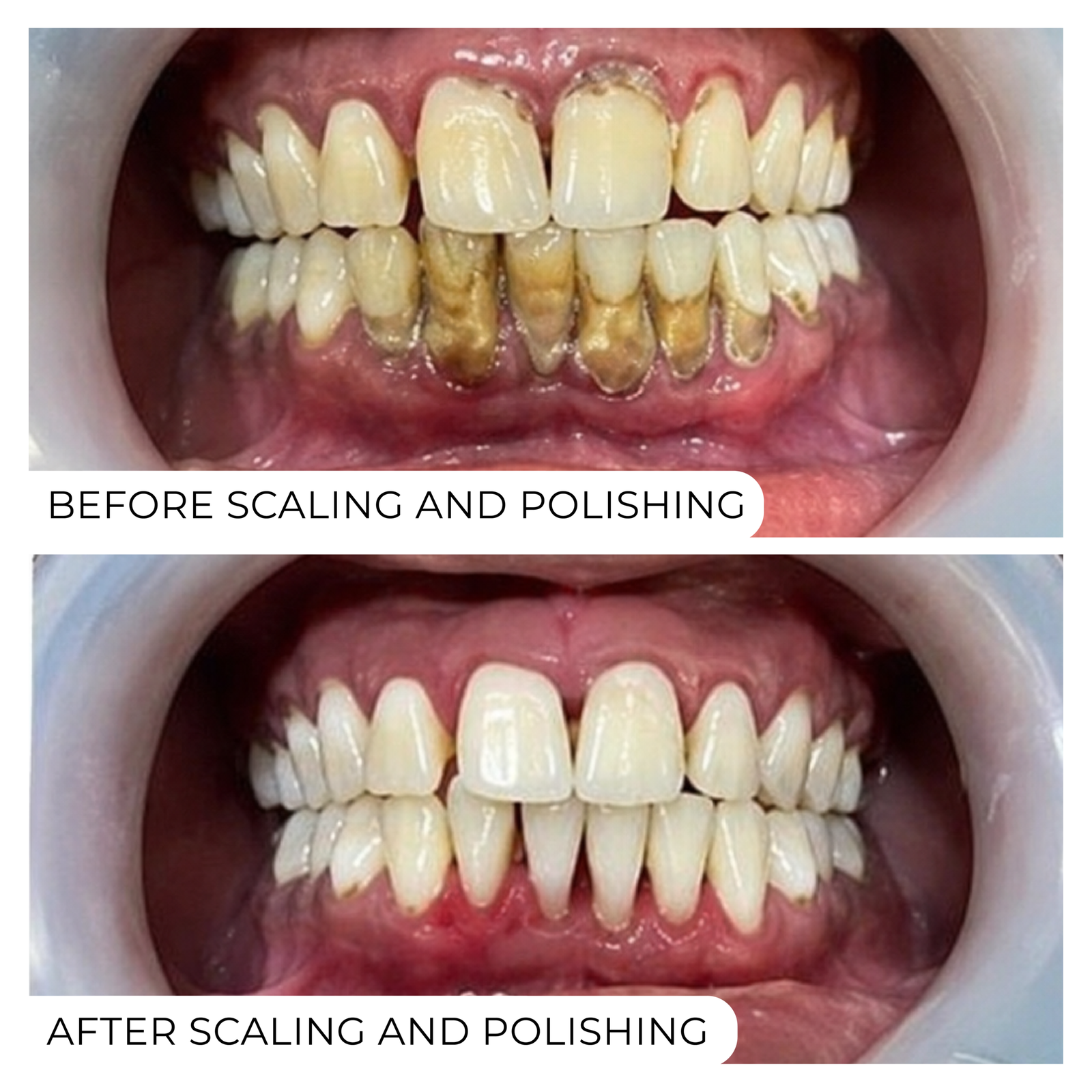 Before After-06