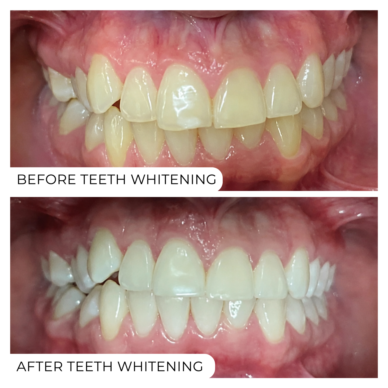 Before After-08