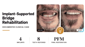 Blog Banner (Case Study) (1)