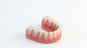 ceramic braces