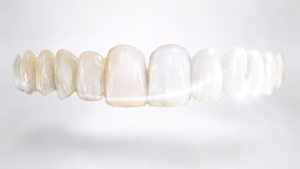teeth whitening cost price
