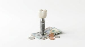 dental implant cost in pakistan karachi