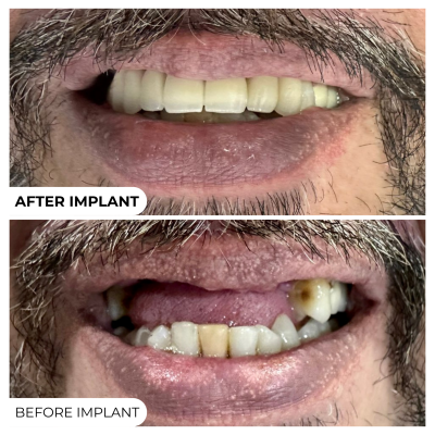 Transformation - 2 (5)